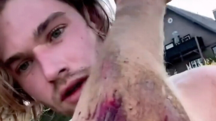 วิดีโอนี้อาจทำให้รู้สึกไม่สบายใจ! โปรดใช้ดุลยพินิจก่อนรับชม! 23