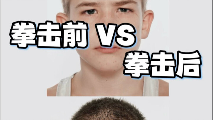 一组照片，看见少年面对疼痛后的眼神