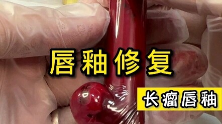 You’ve seen weird lipstick fixes before, but this lip gloss with a “tumor” is something you’ve *neve