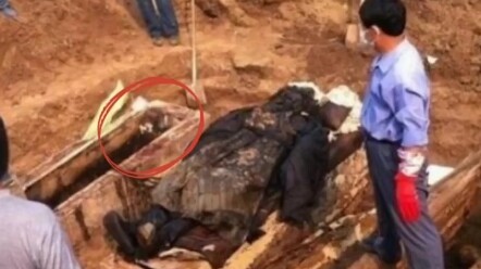 Vụ việc xác sống cắn người