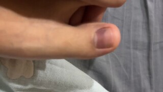 يجب أن يكون قد ازرق بعد معرض الرسومات، كان مؤلماً دائماً، اليوم فقط اكتشفت ذلك، ظننت أنه بسبب التعب، كلما مشيت أشعر بالألم! هذه المرة الأولى التي أواجه فيها هذا الأمر! لا أعتقد أنه سينفصل عن الظفر