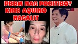 Direk Fredie Valera: PBBM Positive sa CVD, Kriss Aquino nagalit