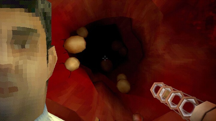 Laughed to Tears by the Patient's Anal Gas