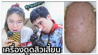 รีวิว เครื่องดูดสิวเสี้ยน ติดกล้อง Xiaomi เกือบทำเสียโฉม?? 👃🏻😨