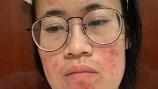 An ordinary "ugly girl"'s determination to become beautiful over the past three years!