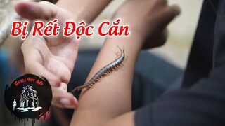 Nam thanh niên 17 tuổi bị Rết Độc cắn hơn 10 lần