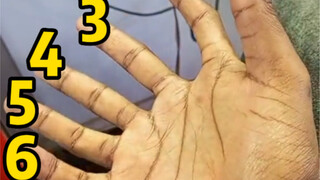 If a hand has 6 fingers, which one is considered the middle finger?