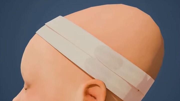 This place deliberately squeezes the head into a point.