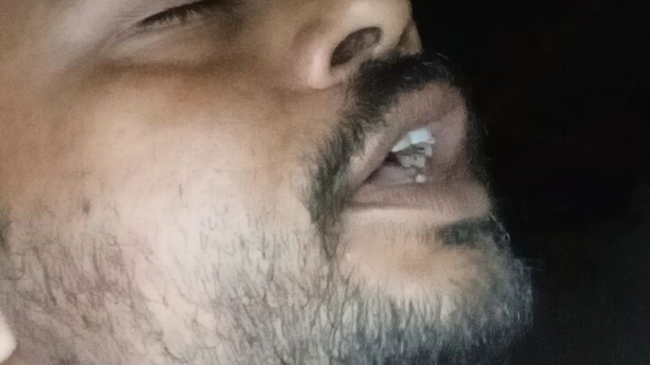 চোখটা এতো পোড়ায় কেন