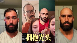 Chuyên mục hói đầu trên Reddit bắt đầu chấp nhận những người đầu trọc rồi‼️