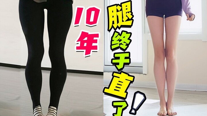 ประสบการณ์ลับเด็ดเรื่องขาสวย 10 ปี! ฉันไม่ได้มี “โชคขาเรียบตรง” แบบนั้น แต่ฉันก็ไม่เชื่อในโชคชะตาอยู