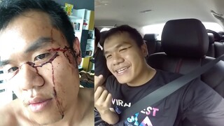 นักรบย่อมมีบาดแผล