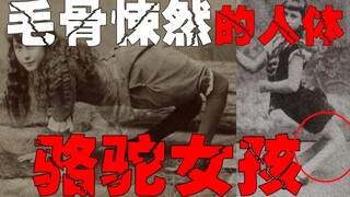 【عرض المشوهين】في القرن التاسع عشر، كانت إحدى الصيحات مروعة إلى هذا الحد، المونولوج الذاتي لحياة هؤلا