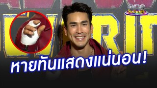 “ณเดชน์” ขอโทษแฟน ๆ พร้อมยันหายทันแสดงแน่นอน  | ประเด็นร้อน2024