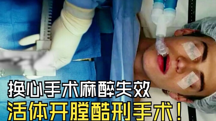 Tim bị moi ra vẫn có thể sống được sao? Hết tác dụng thuốc mê tỉnh dậy chịu mổ sống! "Ca phẫu thuật 