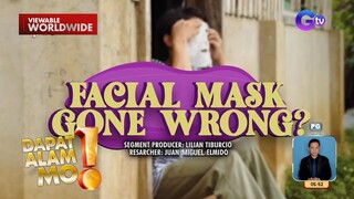 Content creator, kumulubot ang mukha matapos gumamit ng facial mask?! | Dapat Alam Mo!