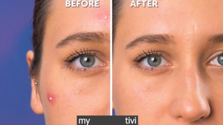 chăm sóc cơ thể đỉnh p4 #mytivi