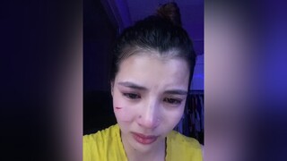 Yêu thương nó nhiều rồi nó vì gái mà đánh tôi như vậy 😭😭😭 mèo nócàochoxướchếttayrồi