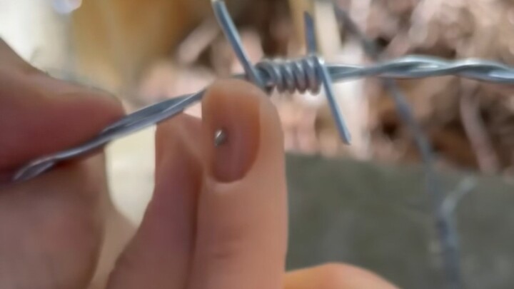 If you get scratched by barbed wire, here’s what you can do.