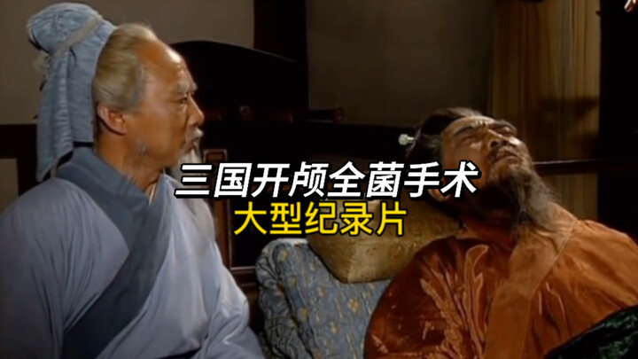 我嘞个全菌开颅手术啊，曹操：不是，你来真的啊……