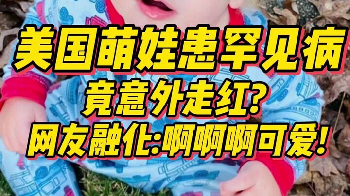 Bocah menggemaskan asal Amerika menderita penyakit langka, malah secara tak terduga jadi viral? Neti