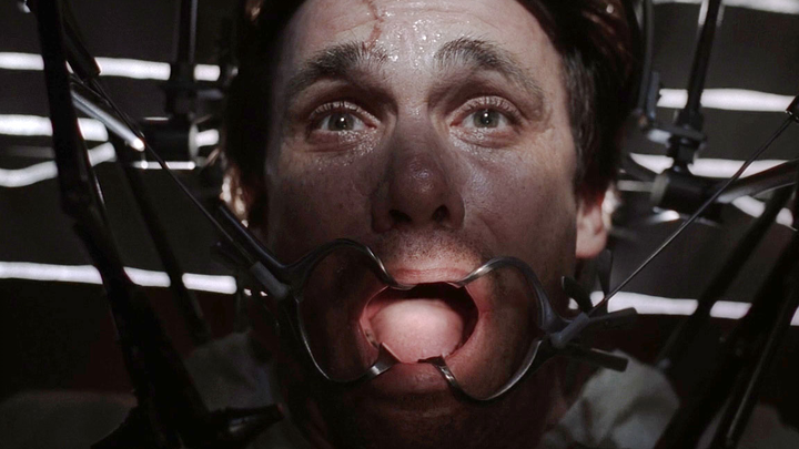 Pria "X-Files" diculik oleh alien untuk eksperimen, giginya dibor, dan pelat logam ditanamkan di tub