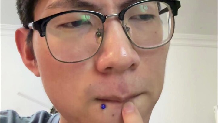 I got a lip piercing, and people keep thinking I’ve got some weird disease growing on my lips…