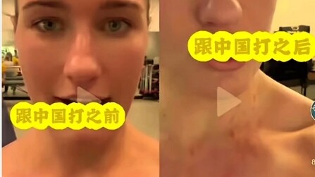 Australian water polo players claim China left them with scratches, accusing them of lacking sportsm