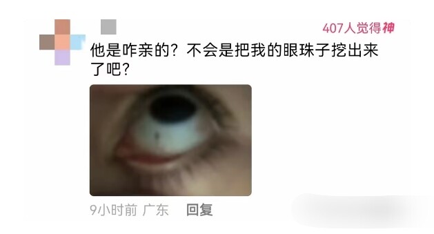 ได้ยินมาว่าไฝคือจุดที่คนรักในชาติที่แล้วเคยจูบมากที่สุด! ชาวเน็ต: อะไรนะ? งั้นเขาไปจูบลูกตาฉันเข้าแล