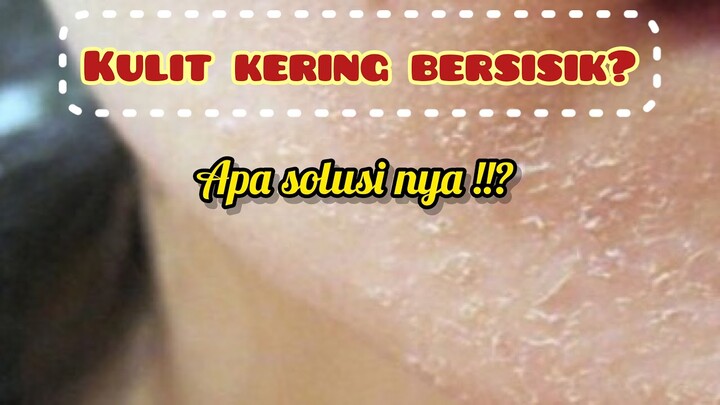 MANTRA Ampuh Mengatasi Kulit Kering