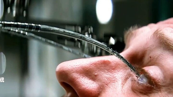 A 30-year-old man who has been blind since birth for 40 years had two nanotubes implanted into his e