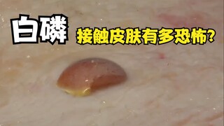 Put 1 gram of white phosphorus on your skin, and after just 2 seconds, you'll understand just how te