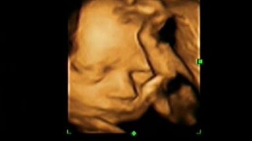 4D ULTRASOUND