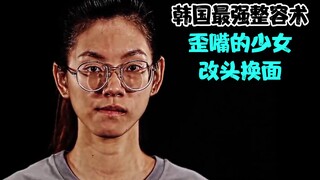 Phẫu thuật thẩm mỹ quyền lực nhất Hàn Quốc: Cô gái có miệng lệch được lột xác hoàn toàn