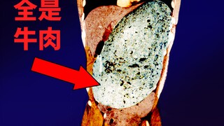 A man ate a 3.6kg hamburger in 30 minutes and this is what happened to his organs