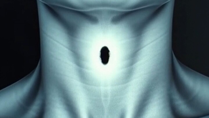 শ্বাসরোধ ছাড়া হাঁচি থামানো বিপজ্জনক! 😱