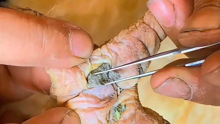 Kaki ayam itu kembali tersangkut di batu, dan bukan hanya satu saja.