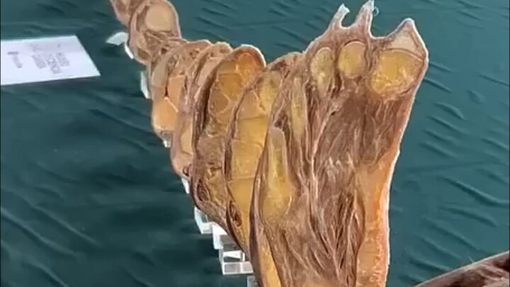 Mengiris satu spesimen tubuh manusia dari kaki hingga kepala, potongan demi potongan menjadi hampir 