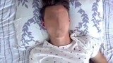 He Wakes Up With NO FACE