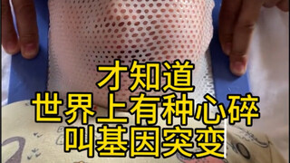 عذراً! أمي جعلتك تتألمين! حبيبي، أحسِنْ صُنْعاً!