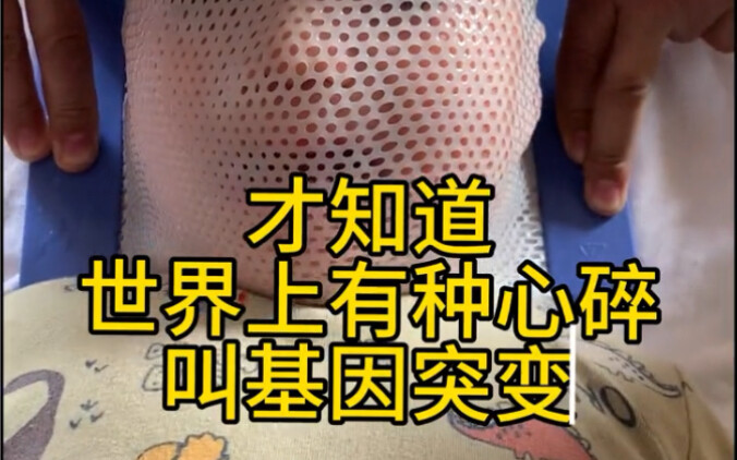 عذراً! أمي جعلتك تتألمين! حبيبي، أحسِنْ صُنْعاً!