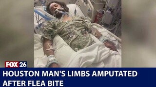 Houston man's limbs amputated after flea bite