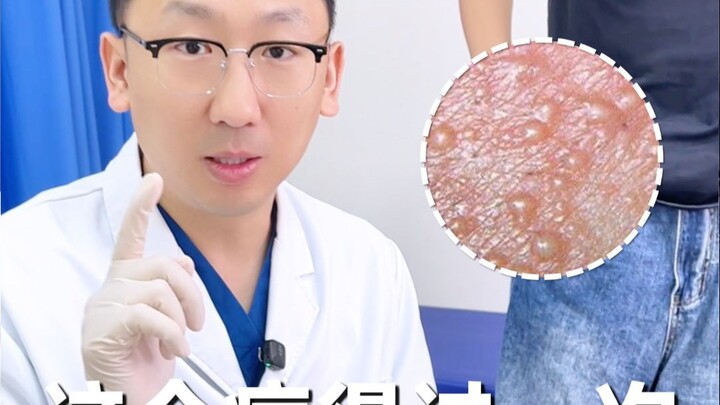 这个性病，感染一次终身标记。