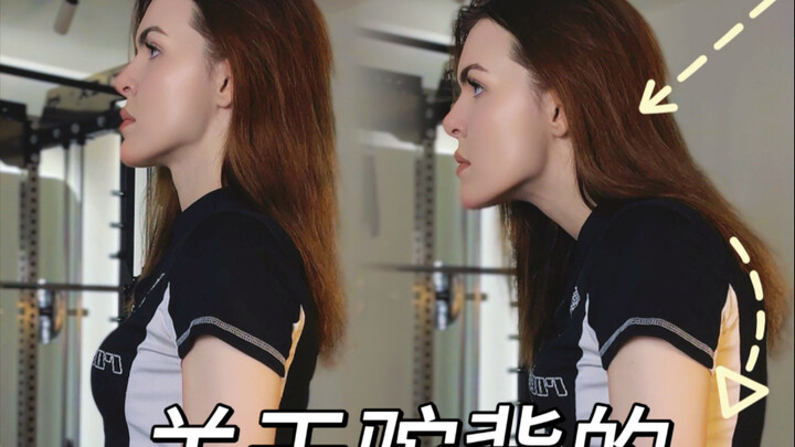 Sự thật trần trụi về chứng gù lưng