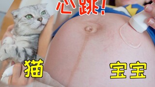 孕妇肚子里的宝宝和猫咪现场测心跳 频率都快到起飞！