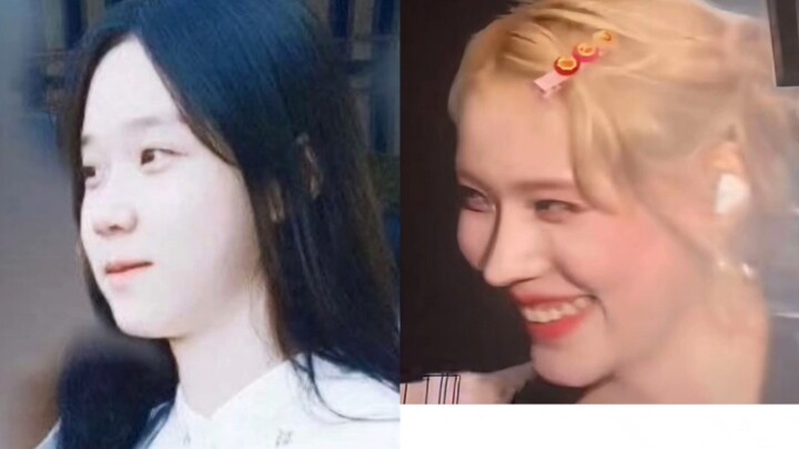 Kim Min-jeong’s Rhinoplasty Side Effects and Timeline