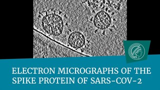 Electron micrographs of the spike protein of Sars-CoV-2