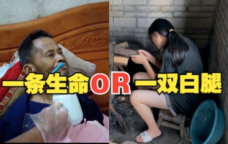 Satu nyawa atau sepasang kaki putih, begitu realistis sekaligus menyedihkan!