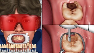 Super refreshing dental treatment process! My brother went to the hospital for the follow-up treatme