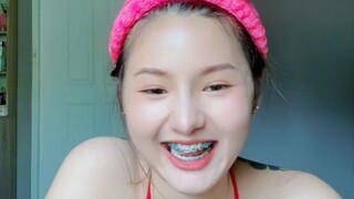 braces 😍 Please follow for more videos!